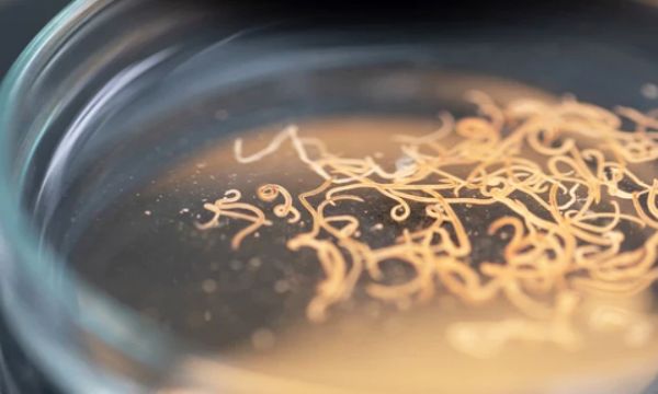 Tıpta görülmemiş vaka: Beyninden canlı solucan çıktı!