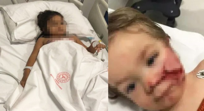 2 kardeşe felaketi yaşatan pitbullun sahibi tahliye edildi