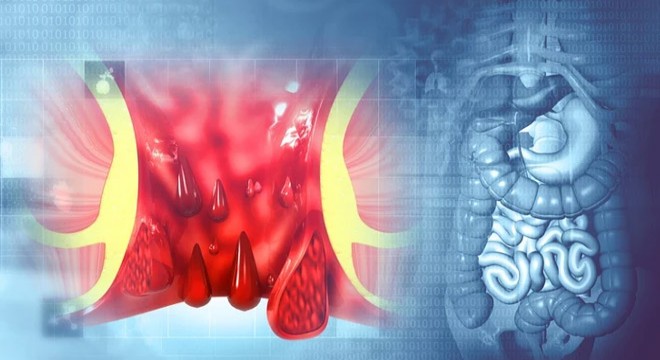 Ağrısız gelişiyor, sinsice ilerliyor!