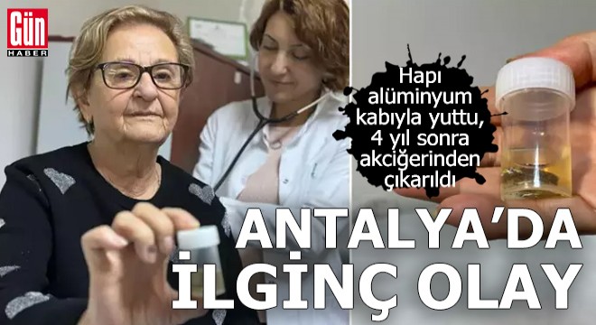 Antalya'da ilginç olay! 4 yıl sonra akciğerinden çıkarıldı