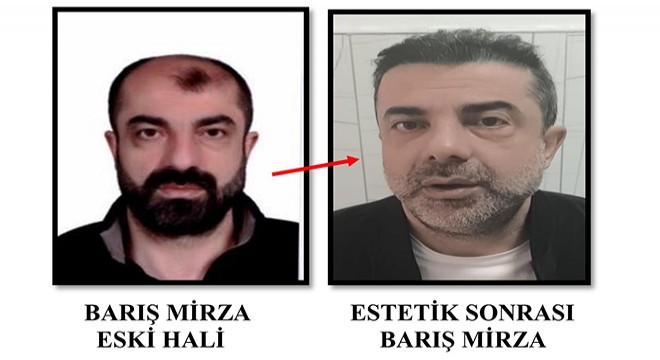 Cinayete azmettiren şüpheli, ameliyatla yüzünü değiştirmiş