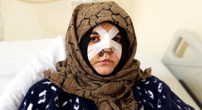 Eşinin dövdüğü Nazlı: Çıkarsa yarım bıraktığı işi tamamlar