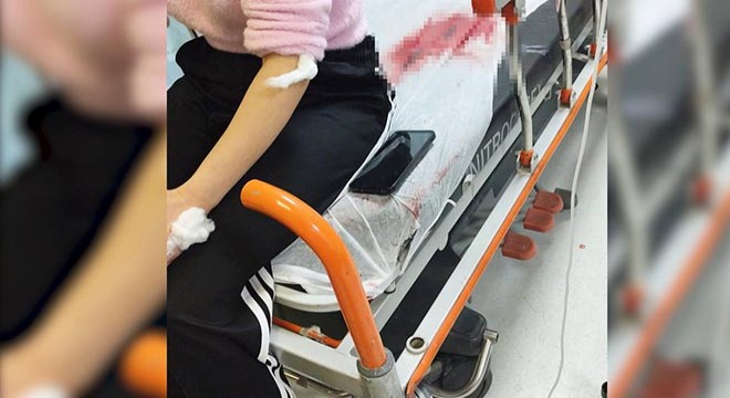 Görümce, eski yengesini bıçakladı