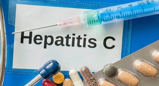 Hepatit C sessiz ilerliyor
