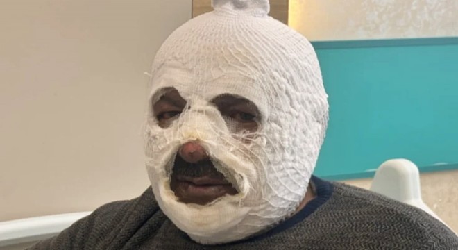 Kalorifer kazanını yakmak istedi canını zor kurtardı