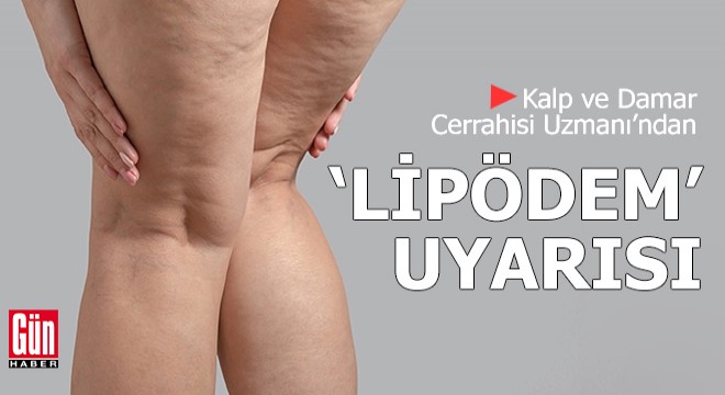 Kalp ve Damar Cerrahisi Uzmanı'ndan ‘lipödem' uyarısı