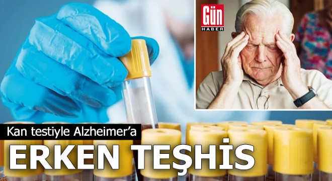 Kan testiyle Alzheimer'a erken teşhis