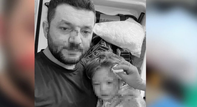 Komşu kavgasında bebek hastanelik oldu