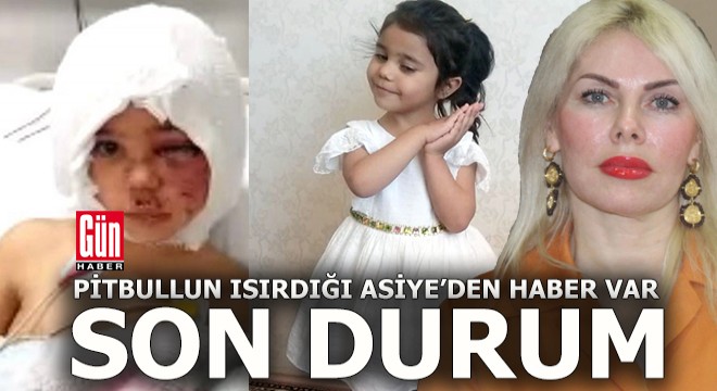 Rektör Özkan, Asiye'nin son durumunu anlattı