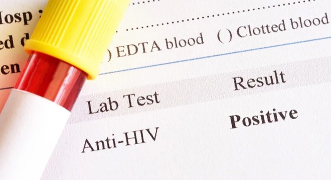 Sonu hapis: AIDS hastalığını gizleyen eş yandı