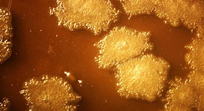 Tümörü içeriden yok eden 'akıllı' bakteriler geliştirildi