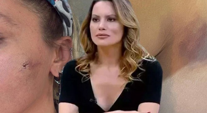 Yıldız Asyalı: Darp ediliyorum